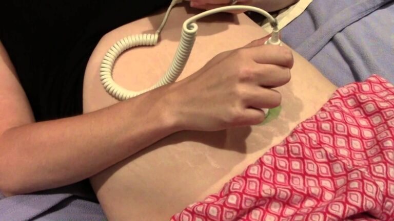 Os 3 principais monitores Doppler de batimentos cardíacos fetais: Cuco, você está aí?